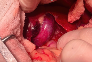 6154542afc6f0d4d29d92dfb4a8f398a