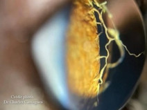 893d67e022f420c17ab085e1a30c73e6