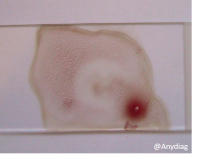 eff9e40b51127c2584b10473ff5d69d0