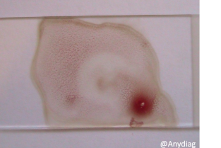 eff9e40b51127c2584b10473ff5d69d0