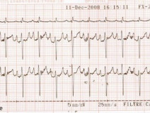 72f9fc609001d885cf01708bf9d26a86